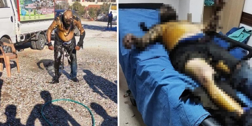 Zabıtaya kızıp kendini yakan kömür satıcısından acı haber: Hayatını kaybetti!