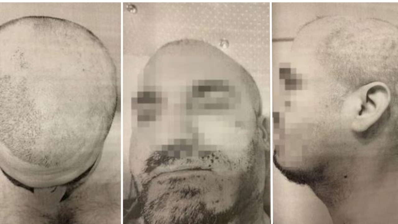 Öğrenci yurdunda akılalmaz işkence: Sıcak ağdayla sakallarını ve saçlarını kökünden kopardılar!