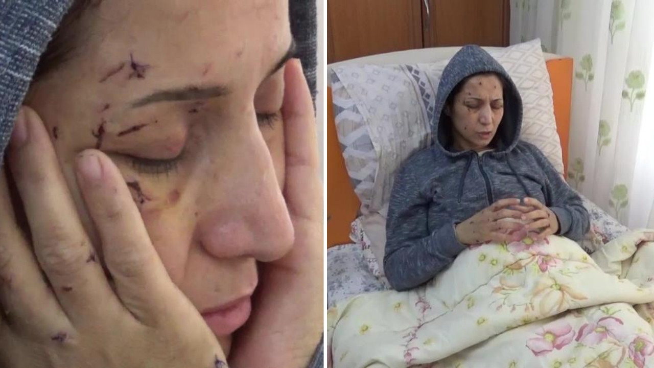 Elini öpmeyen 2,5 yaşındaki yeğenini dövdü, yengesini 50 yerinden bıçakladı!