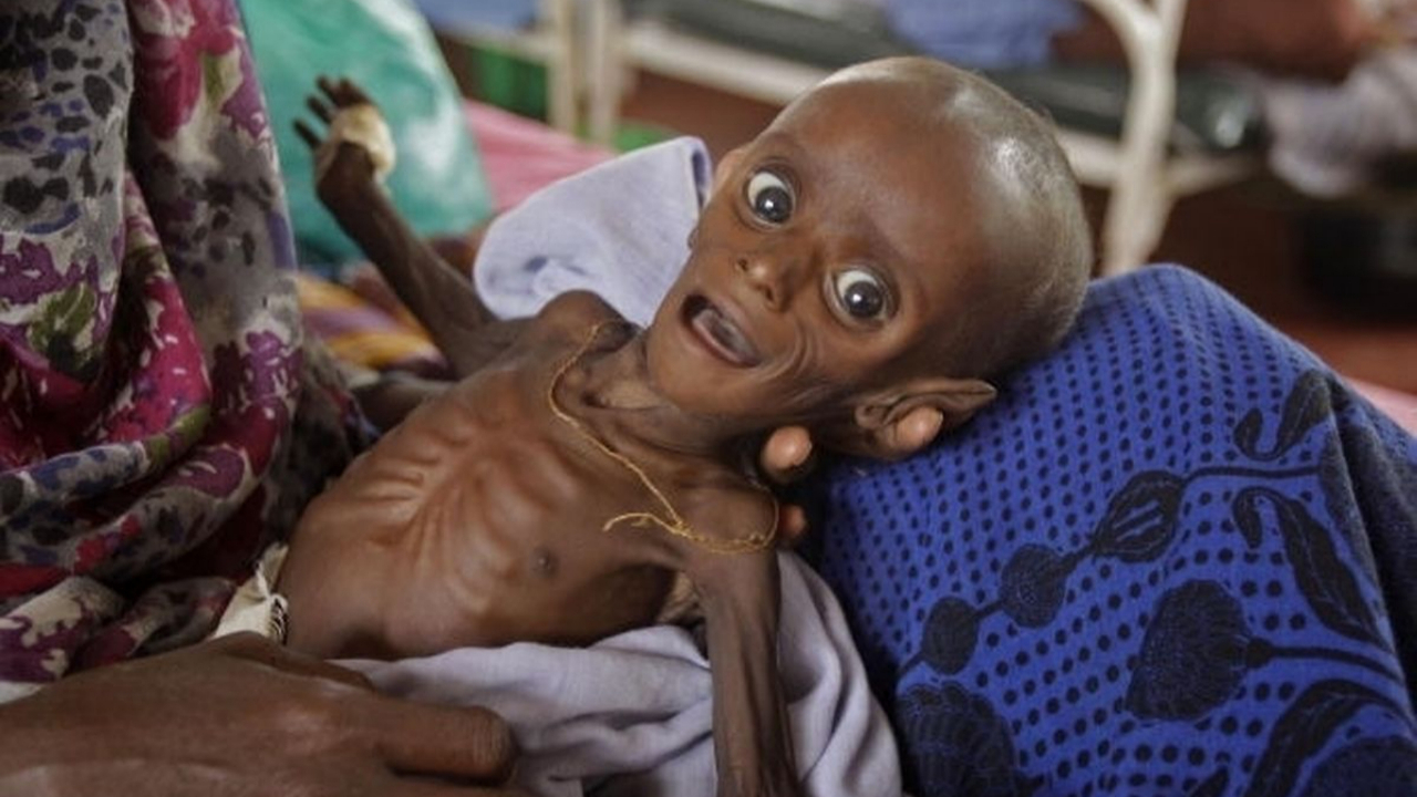 Afrika Boynuzu alarmda: Somali ve Etiyopya kuruyor!