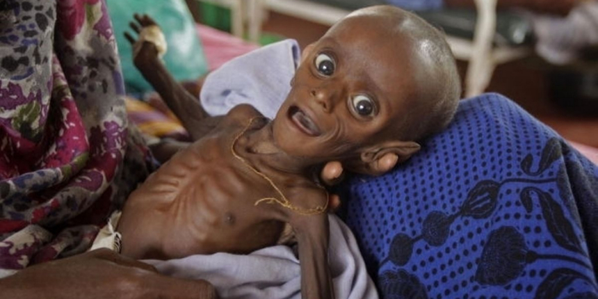 Afrika Boynuzu alarmda: Somali ve Etiyopya kuruyor!