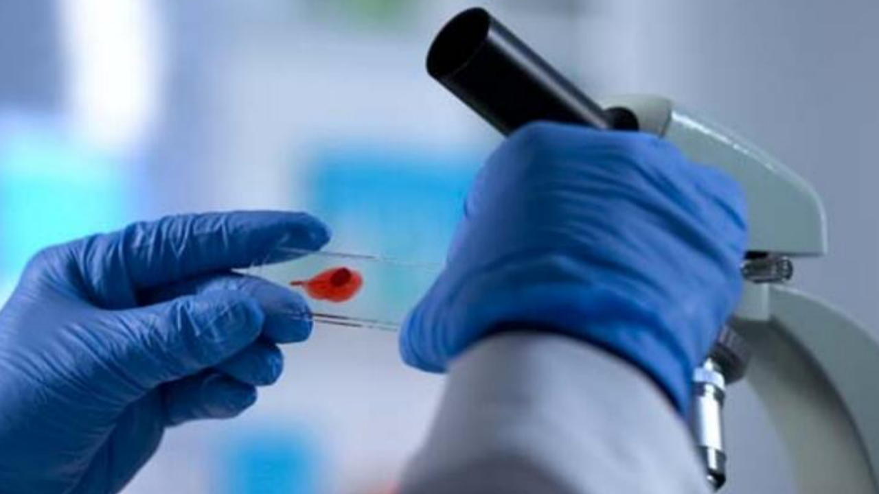 AIDS vakalarını 2 katına çıkaracak yeni bir HIV varyantı tespit edildi