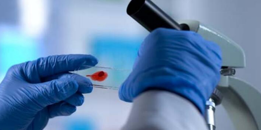 AIDS vakalarını 2 katına çıkaracak yeni bir HIV varyantı tespit edildi