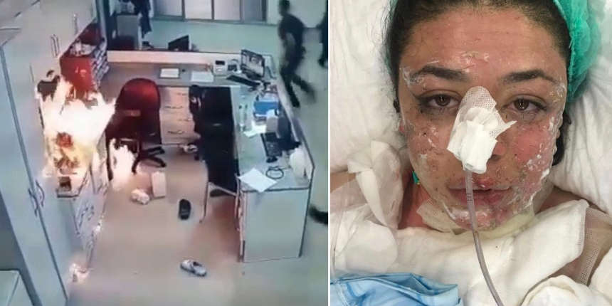 Acil servisteki patlamada dehşeti yaşayan Gizem hemşire korku dolu anları anlattı: Diri diri yandım!