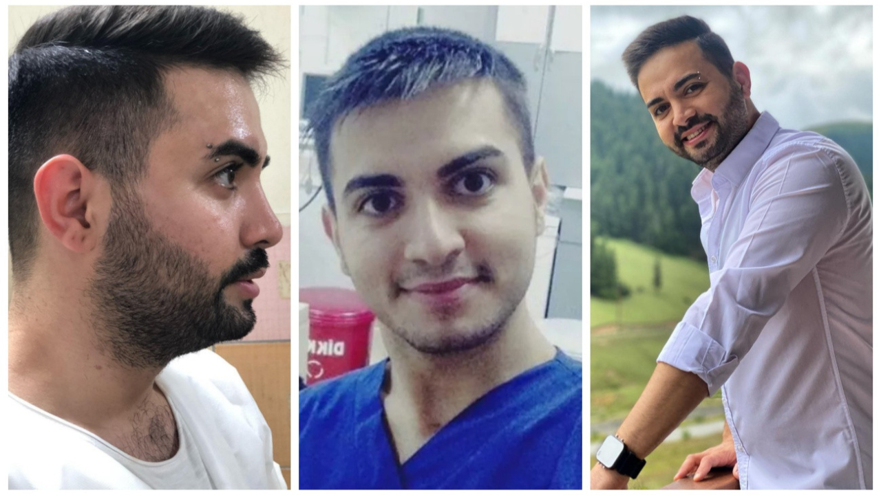 Kadir Ezildi'nin burun estetiği yaptırmadan önceki hali ortaya çıktı