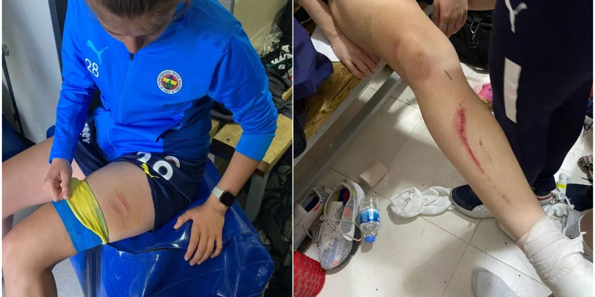 Fenerbahçe Kadın Futbol Takımı'na Diyarbakır'da saldırı! Futbolcular yaralandı...