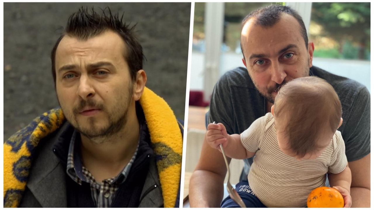 Hazal Kaya ikna etti! Saçları dökülen Ali Atay saç ektirdi