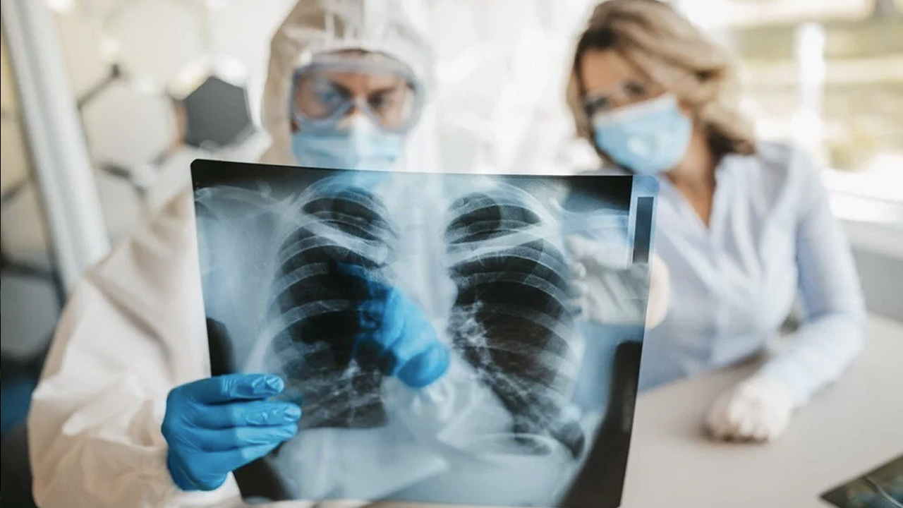 Canlı yaşamını tehdit eden mikroplastikler ilk kez insan akciğerinde görüldü