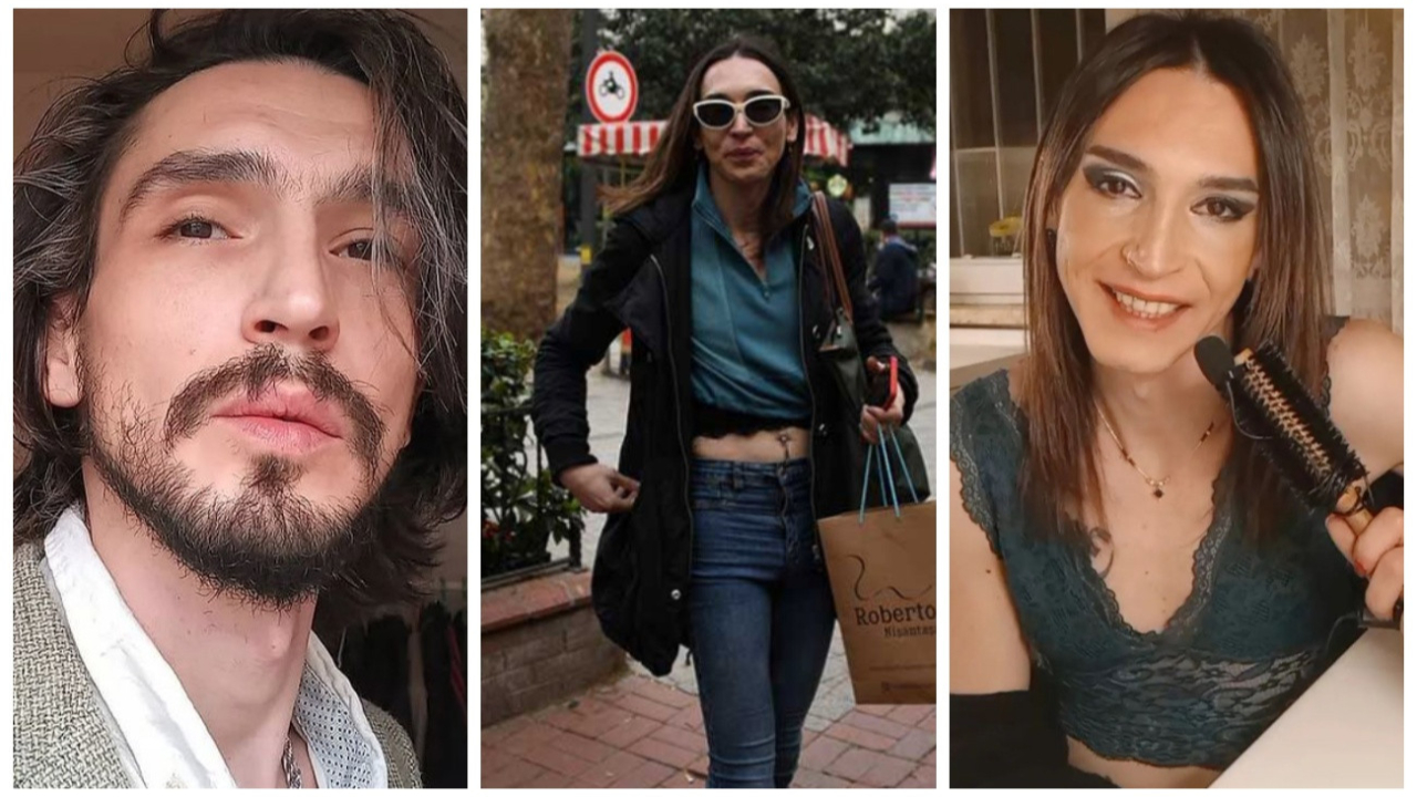 Trans birey olduğunu duyuran Ahmet Melih Yılmaz estetik operasyon geçirdi! İşte son hali...