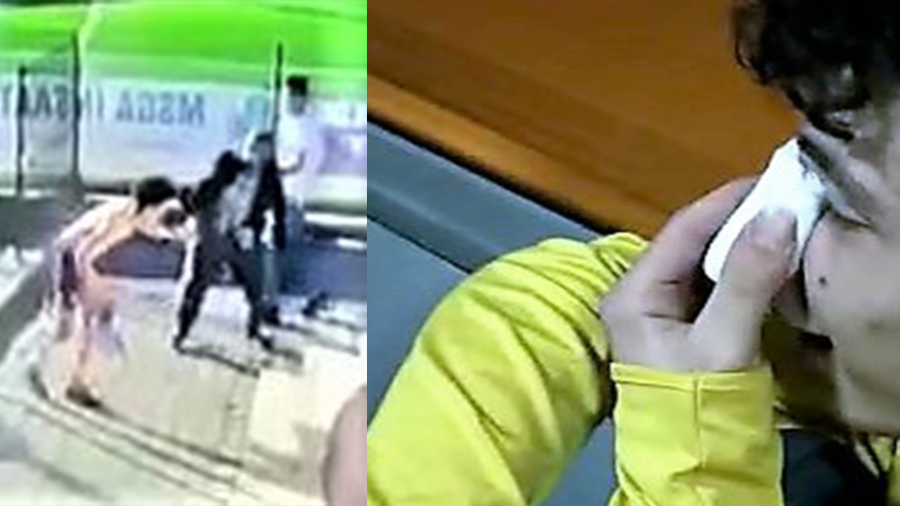 Amigonun attığı yumrukla burnu kırılan futbolcu ameliyat oldu