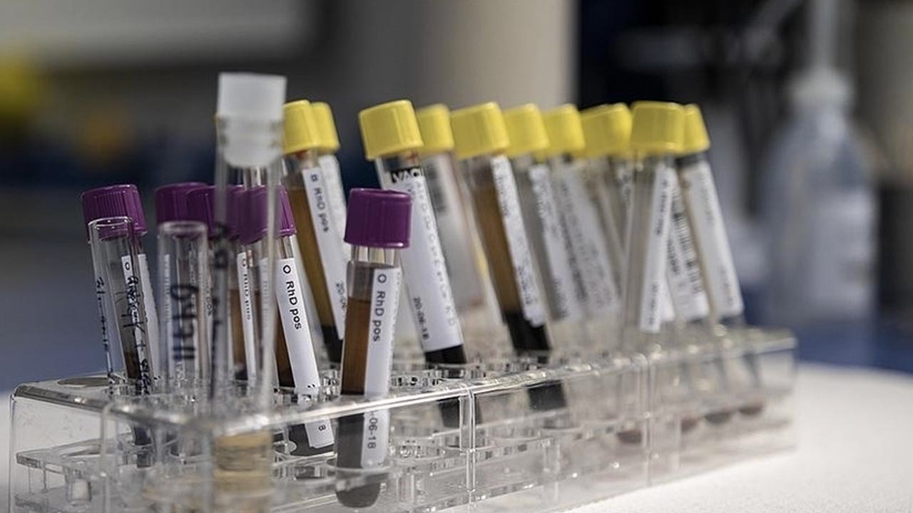Gizemli hepatit virüsü tehlike saçıyor: Bir ülkede daha çıktı