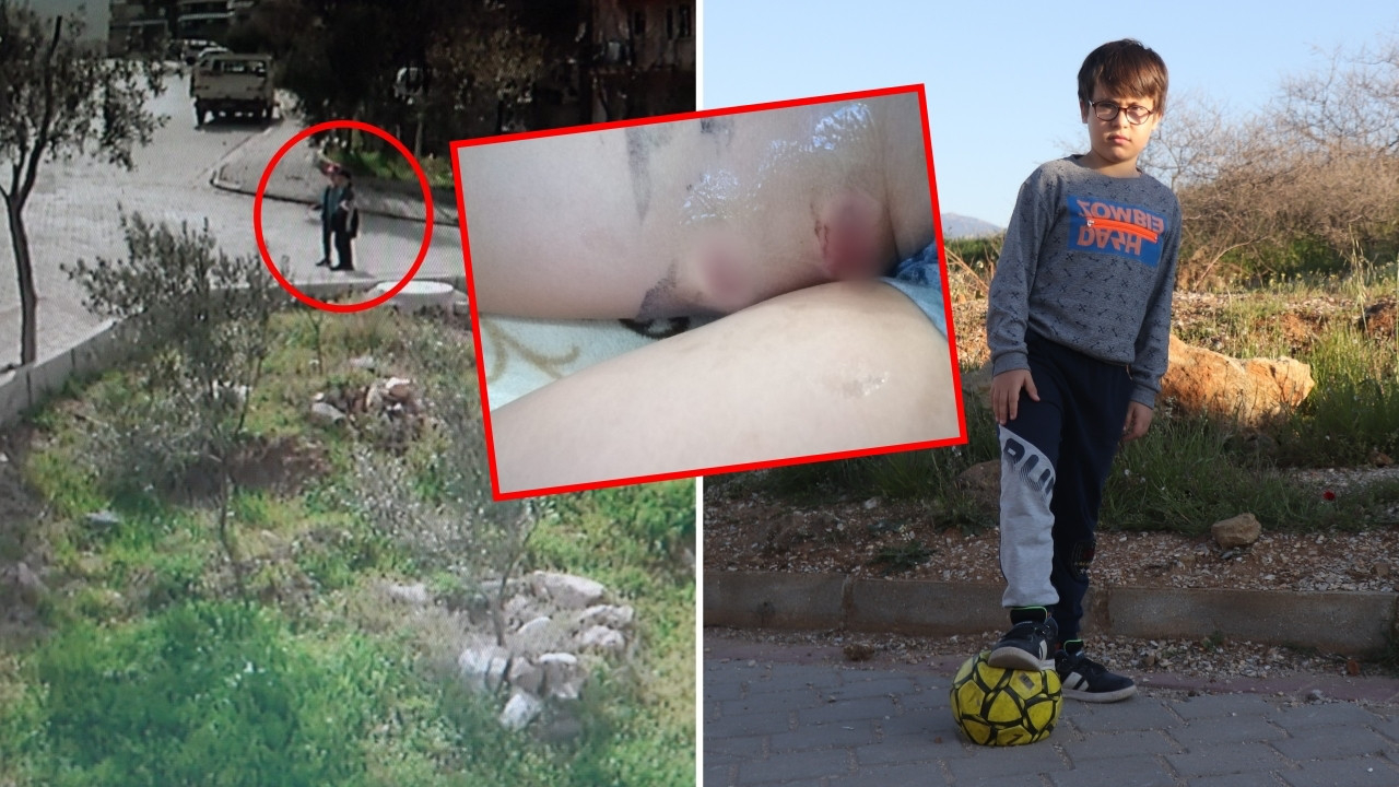 Başıboş 5 köpek 9 yaşındaki çocuğa saldırdı: Ölü taklidi yaparak kurtuldu!