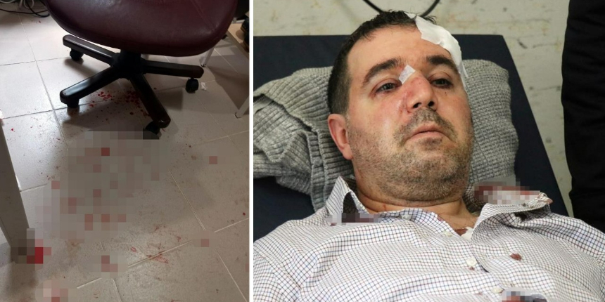 "Beni rahatsız ediyorsun" diyerek saldırdığı doktorun burnunu kırdı!