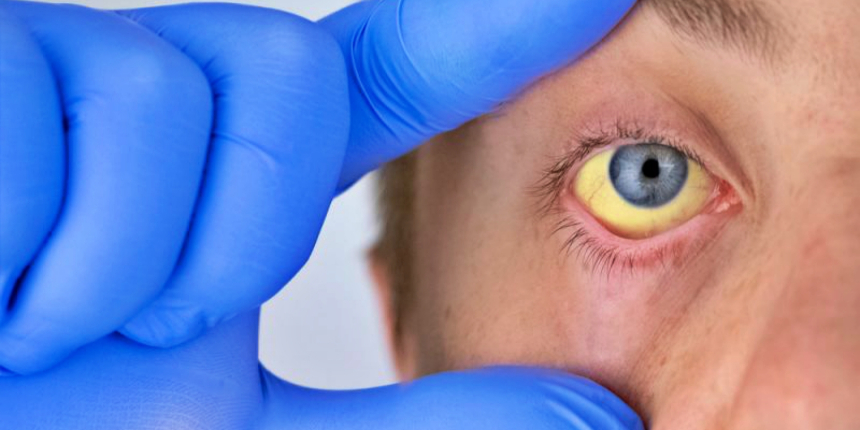 Şimdi de Meksika'da görüldü: Gizemli hepatit 20 ülkeye yayıldı!