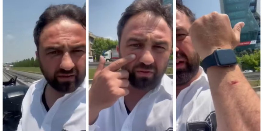 CHP’li İBB’nin Zabıta ekipleri, İTO üyesi Fatih Ellazoğlu’nu darp etti