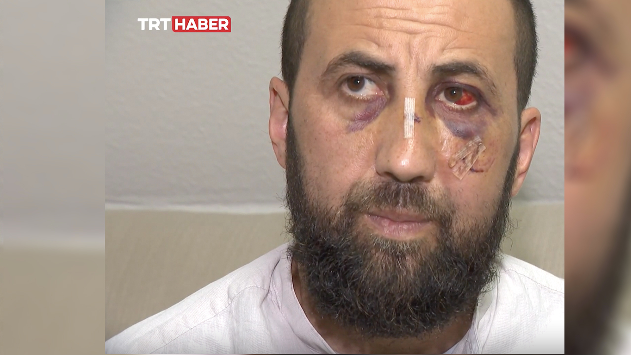 Alman polisi, Türk aileye kabusu yaşattı: Eşinin önünde dakikalarca darp etti