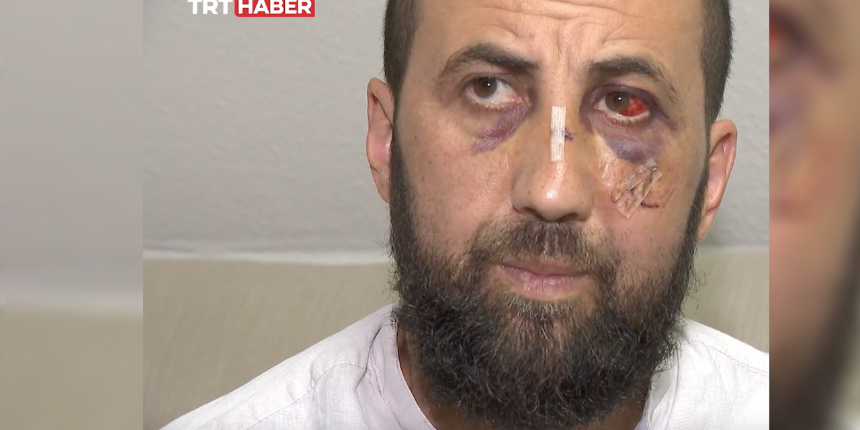 Alman polisi, Türk aileye kabusu yaşattı: Eşinin önünde dakikalarca darp etti