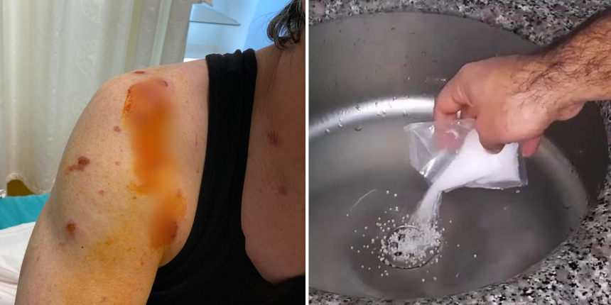 Lavabo açıcı bomba gibi patladı: 61 yaşındaki adam dehşeti yaşadı!