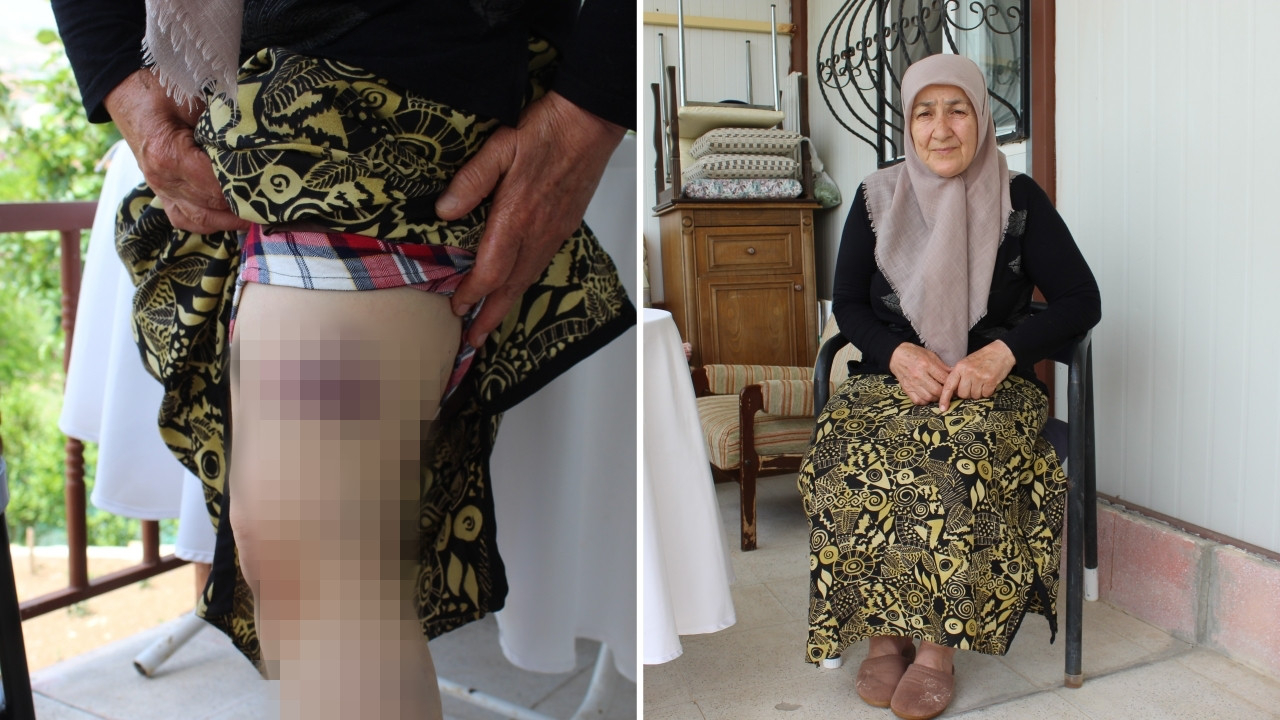 72 yaşındaki kadın 13 başıboş köpeğin saldırısına uğradı: Ölümün eşiğinden döndü!