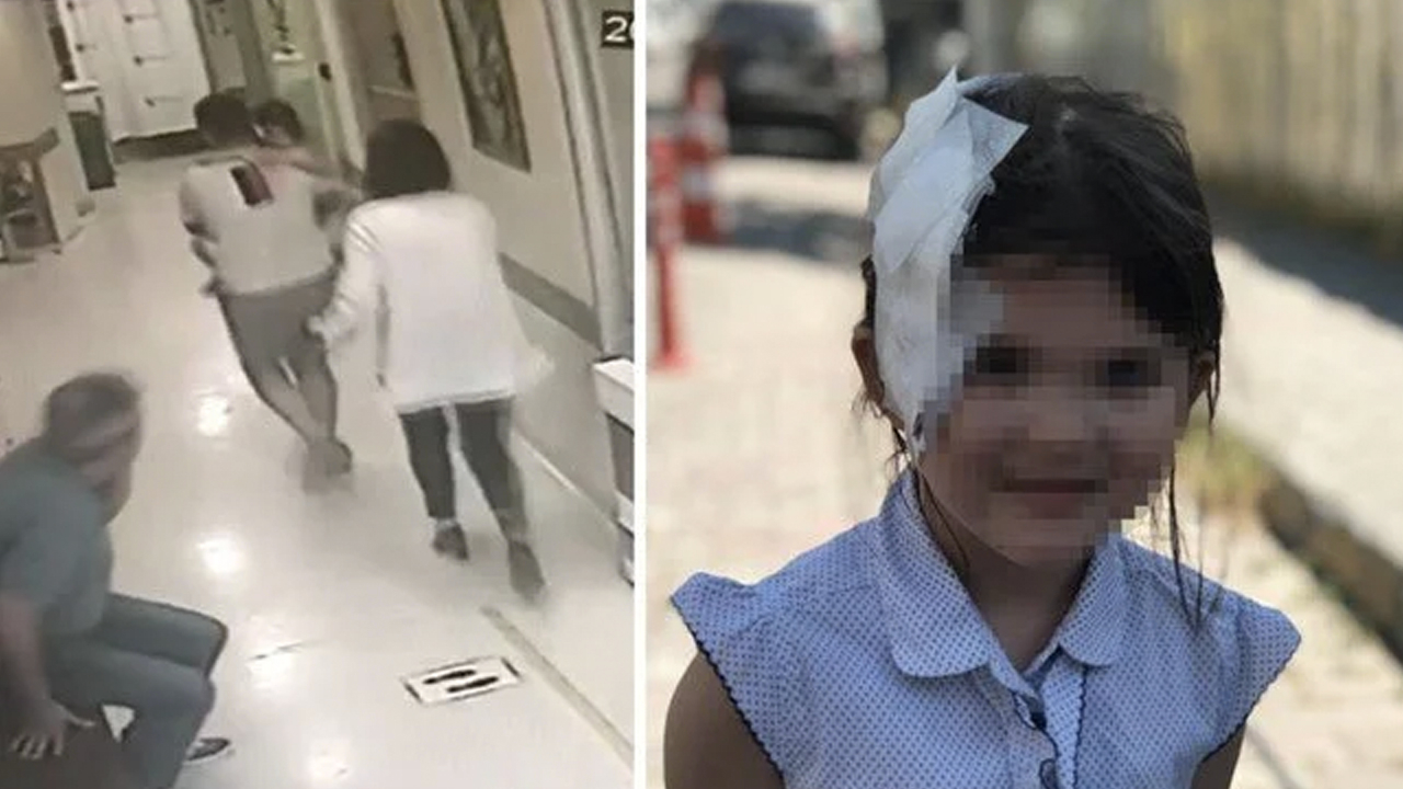 Bir pitbull dehşeti de İstabul'da yaşandı: Küçük çocuğu feci şekilde yaraladı