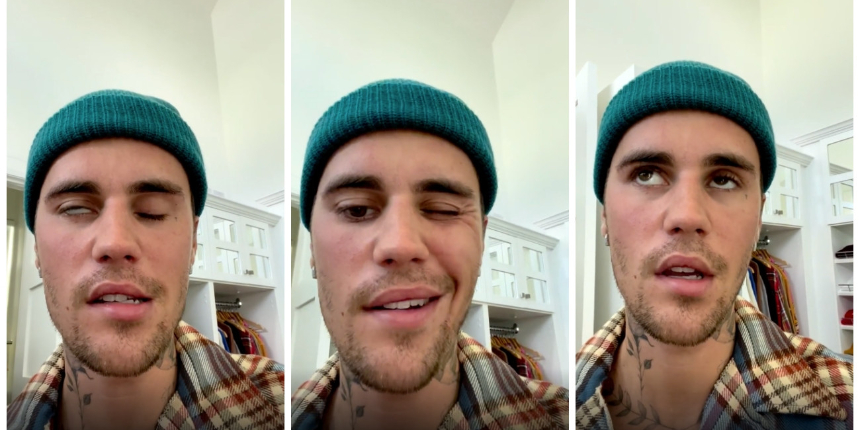 Sağlık sorunlarıyla savaşan Justin Bieber'dan bir kötü haber daha: Yüz felci geçirdi