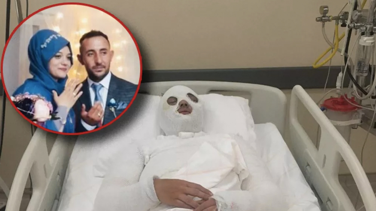 Eski nişanlısı dehşeti yaşattı! 'Su saatine bakacağız' dedi, yüzüne kezzap attı
