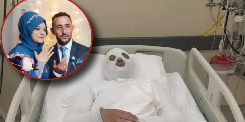 Eski nişanlısı dehşeti yaşattı! 'Su saatine bakacağız' dedi, yüzüne kezzap attı