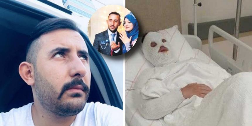 Eski nişanlıya kezzaplı saldırı! Zanlının ifadesi pes dedirtti: Zarar vereceğini bilmiyordum"