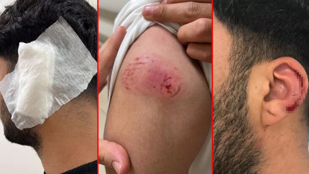 Galata'da iki grup arasında çıkan kavgada tekme, sopa, yumruk ve falçata havada uçuştu!
