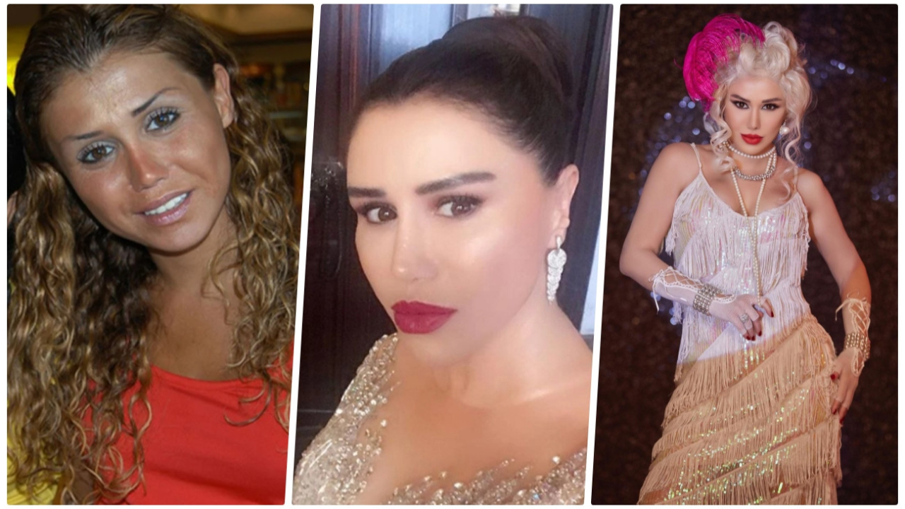 'Küçük Ceylan'ın son halini görenler gözlerine inanamadı! Şarkıcı Ceylan estetiğin dozunu kaçırdı