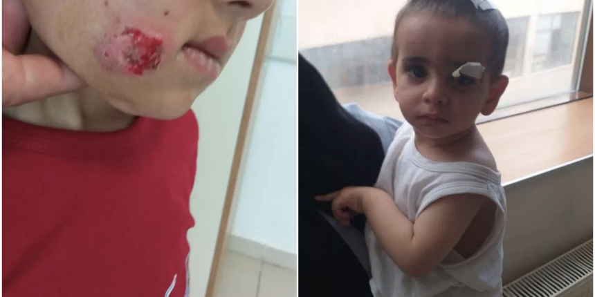 Ağrı'da sokak köpeklerinin saldırdığı 2 yaşındaki Ali Asaf'tan acı haber