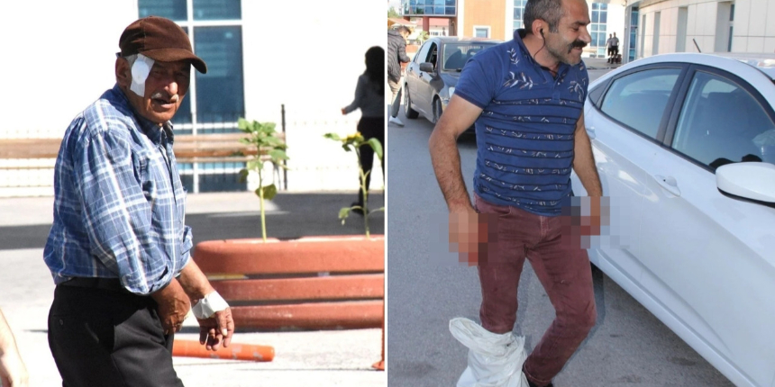 Bir bayram klasiği: Acemi kasaplar acil servislere akın etti!