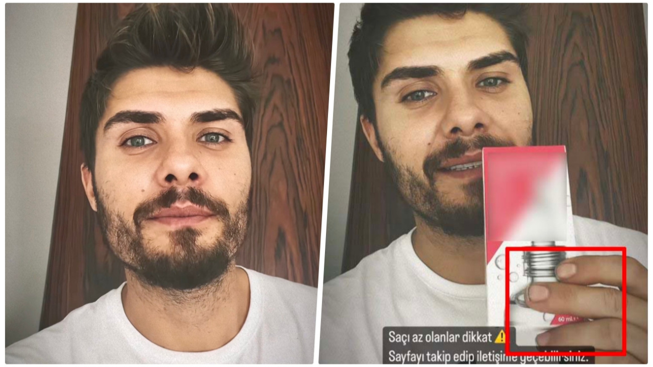 Barış Murat Yağcı'nın bakımsız ve kirli tırnakları sosyal medyanın diline düştü