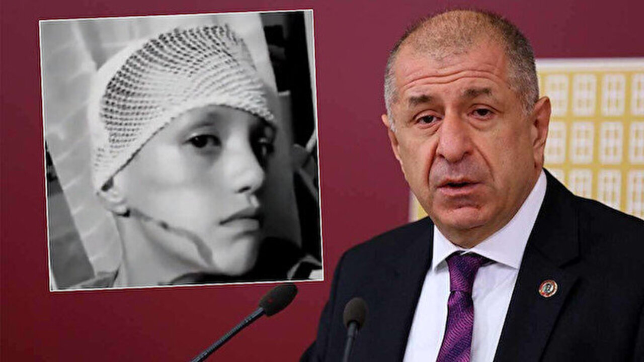 Ümit Özdağ'dan bir yalan daha! 'Suriyeliler küçük çocuğa kezzap attı' demişti, gerçek başka çıktı