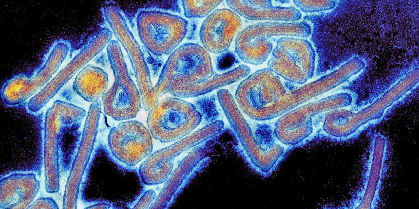 Marburg humması salgını! Aşısı ve özel tedavisi yok, ölüm oranı yüzde 90'a ulaşıyor
