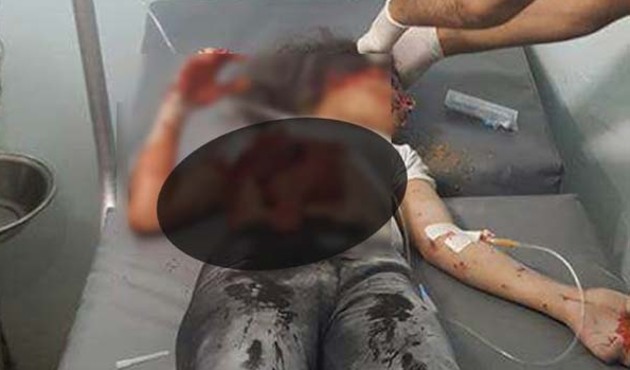 Katliamı TSK duyurdu: PKK, Mare'de sivilleri öldürdü!