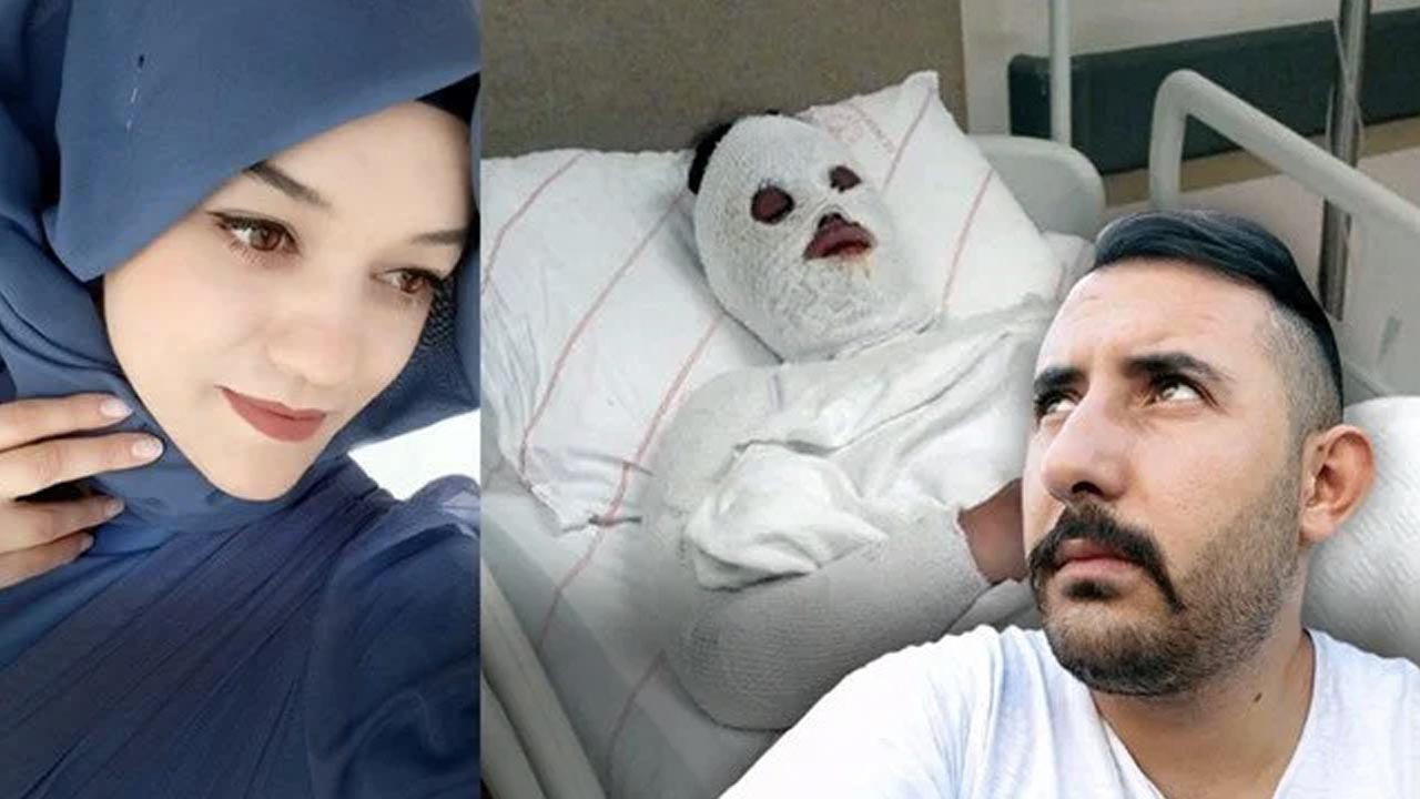 Eski nişanlısı kimyasal sıvıyla yüzünü yakmıştı: Talihsiz kadın olaydan 3 gün önce koruma için başvurmuş