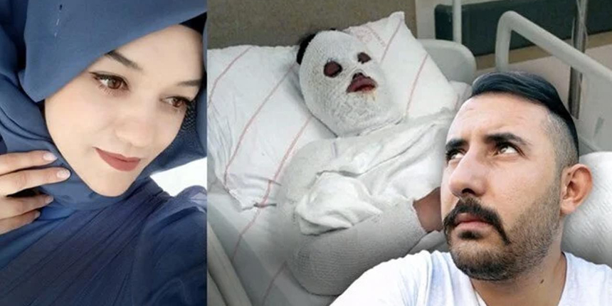 Eski nişanlısı kimyasal sıvıyla yüzünü yakmıştı: Talihsiz kadın olaydan 3 gün önce koruma için başvurmuş
