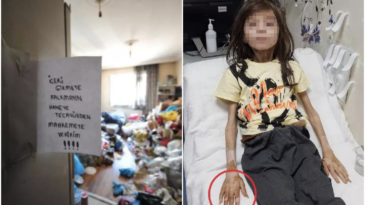 1 yıldır çöp dolu odada kilitli tutulmuştu! Bursa'daki çöp evden yeni gelişme!
