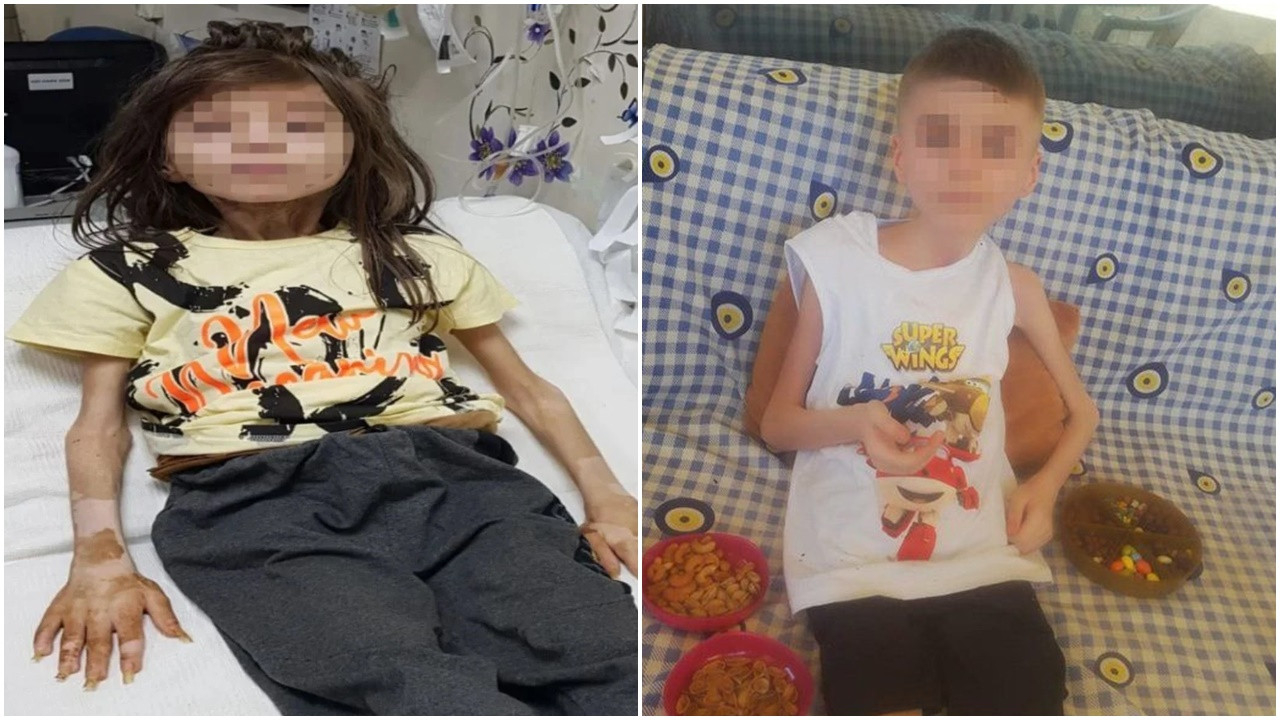 Psikiyatrist Fatih Öncü, çöp evden çıkan dramla ilgili merak edilen soruları yanıtladı