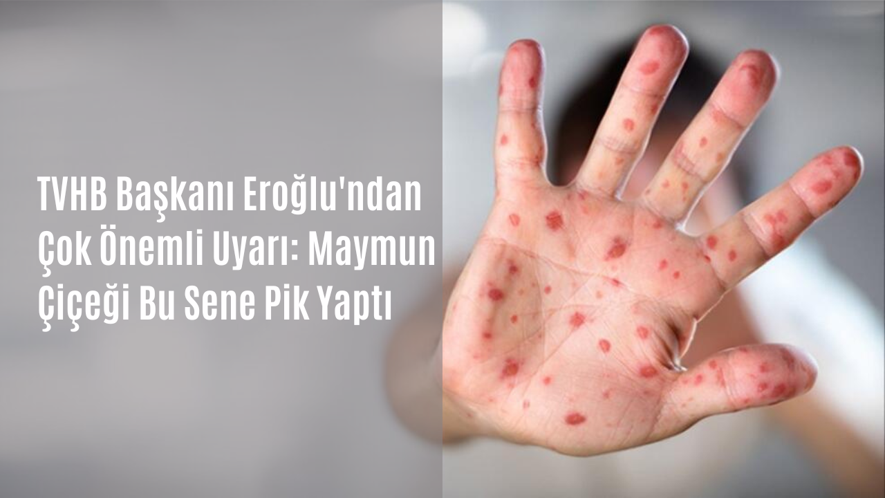 TVHB Başkanı Eroğlu'ndan çok önemli uyarı: Maymun çiçeği bu sene pik yaptı