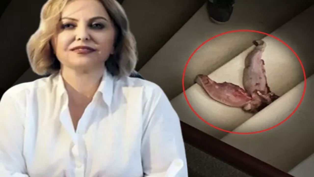 Prof. Dr. Şenol'a dehşeti yaşattı: Dana dili ve ölüm tehditleri tüyler ürpertti
