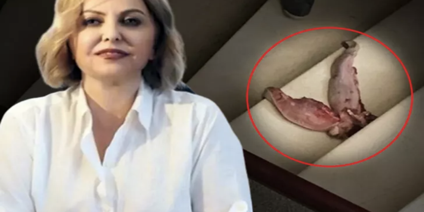 Prof. Dr. Şenol'a dehşeti yaşattı: Dana dili ve ölüm tehditleri tüyler ürpertti
