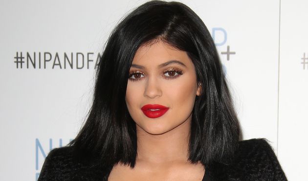 Kylie Jenner'in bacağına direk girdi!