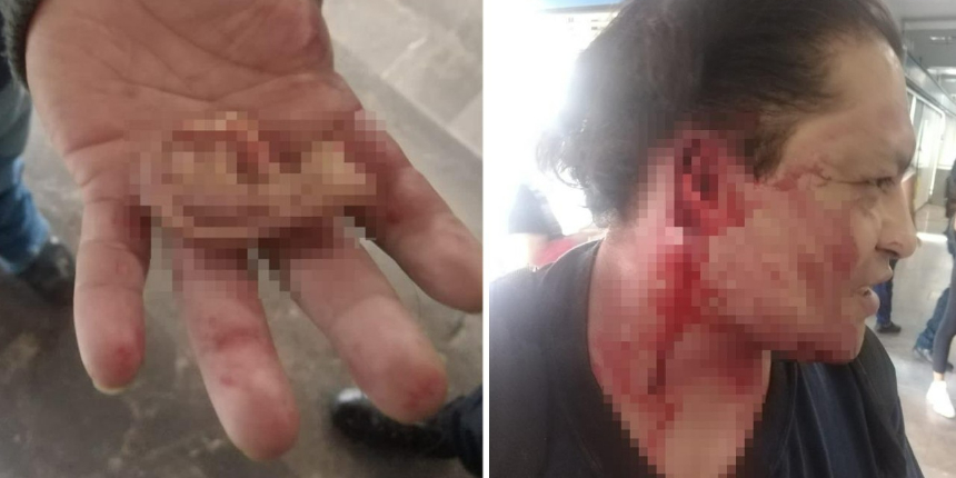 Meksika'da metroda taciz kavgası! Yolculardan biri tacizcinin kulağını koparttı
