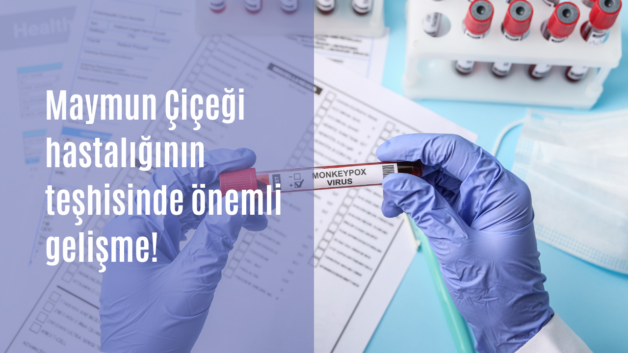 Maymun Çiçeği hastalığının teşhisinde önemli gelişme! 1 saatte tanı koyulabiliyor