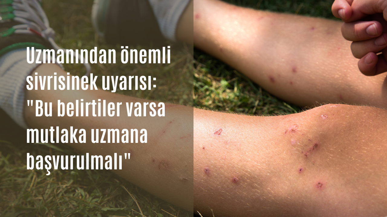 Uzmanından önemli sivrisinek uyarısı: "Bu belirtiler varsa mutlaka uzmana başvurulmalı"