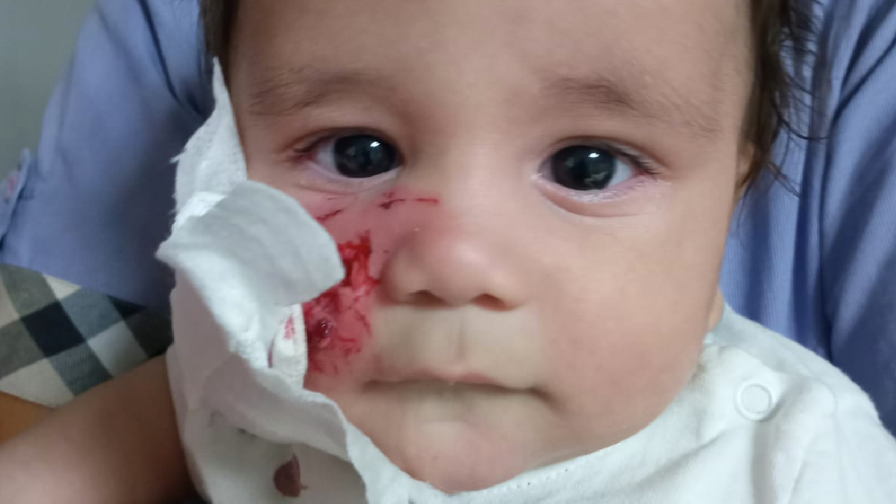 Hatıra fotoğrafı çektireceklerdi, 4 aylık bebeği at ısırdı