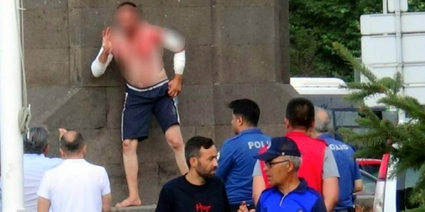 Cam parçalarıyla kendini kesti!