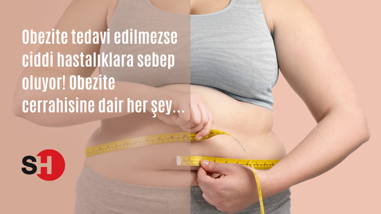 Obezite tedavi edilmezse ciddi hastalıklara sebep oluyor! Obezite cerrahisine dair her şey…